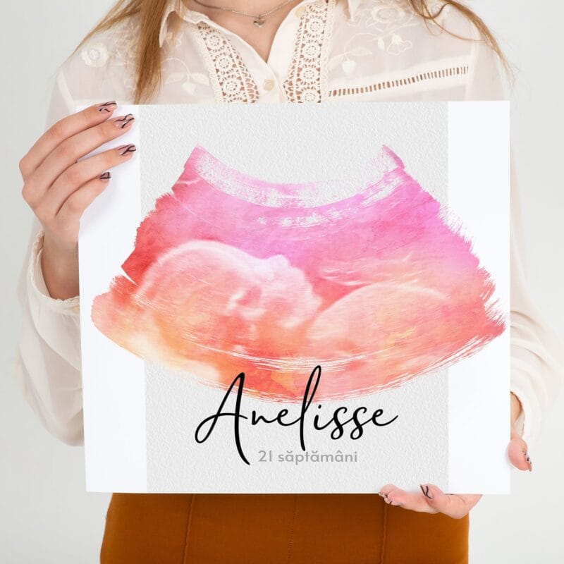 tablou canvas personalizat ecografie